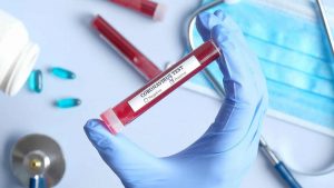 Leia mais sobre o artigo Covid-19: infecções no mundo aumentaram 70% na semana passada, diz OMS