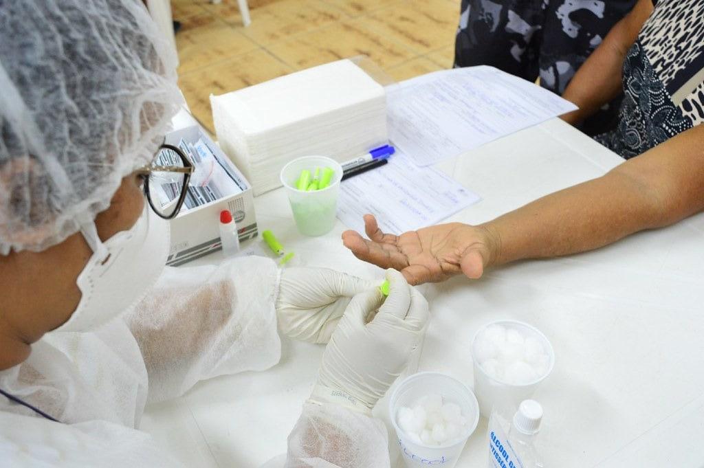 No momento, você está visualizando Governo do Estado oferta mais de 20 mil testes rápidos para HIV e quase um milhão de preservativos