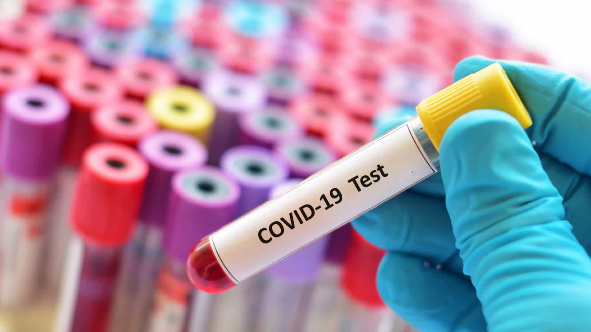 No momento, você está visualizando Brasileiro precisará de exame negativo de Covid-19 para embarcar para o país
