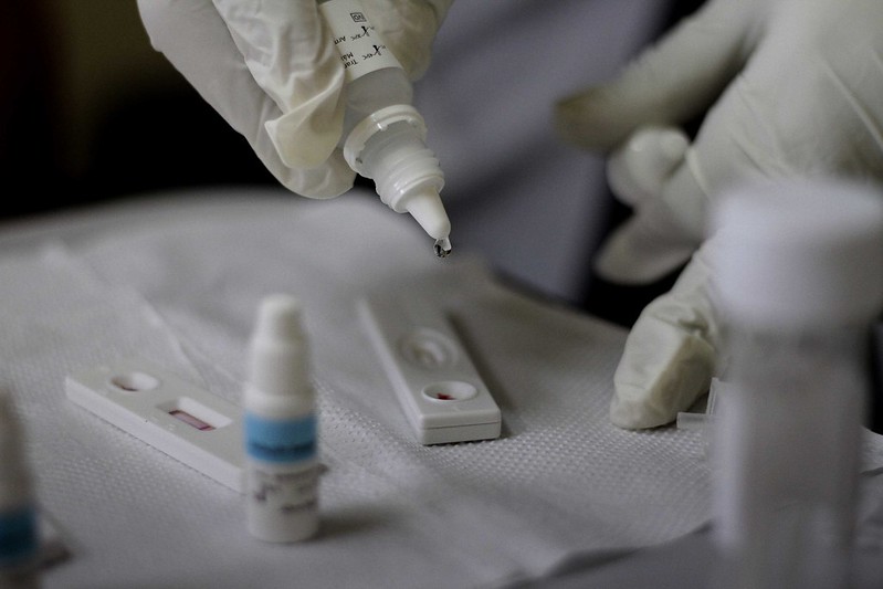 No momento, você está visualizando Grupos vulneráveis recebem estratégia de prevenção ao vírus HIV