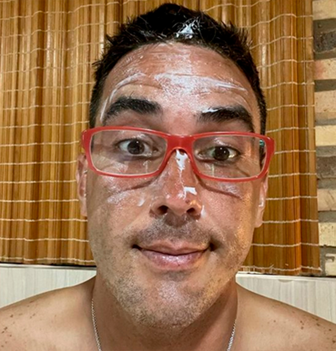 Leia mais sobre o artigo No Limite: André Marques é picado por vespa: ‘dói pra cara***’