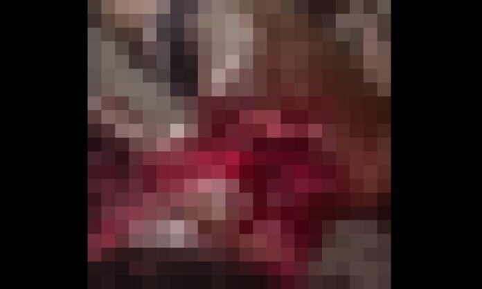 Leia mais sobre o artigo Suspeito de armar emboscada é decapitado a golpes de terçado