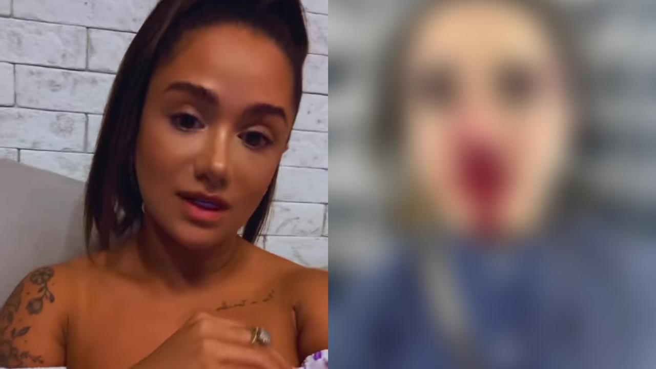 Leia mais sobre o artigo Blogueira Raphaella Moura é agredida em restaurante de Manaus; veja foto