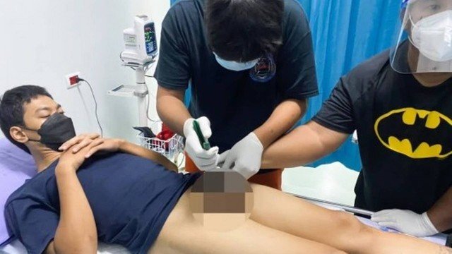 Leia mais sobre o artigo Homem fica com pênis preso em cano de PVC