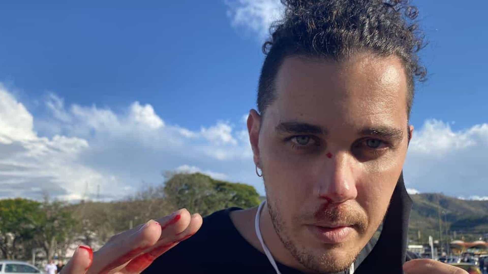 Leia mais sobre o artigo Cinegrafista da GloboNews é agredido por bolsonarista