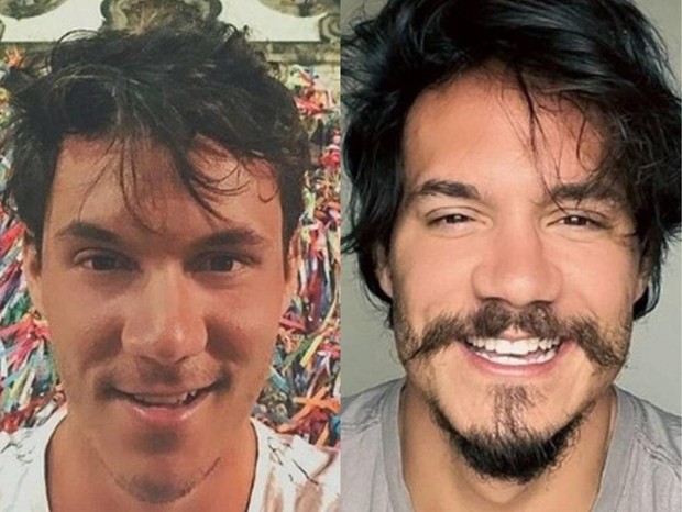No momento, você está visualizando BBB 22: Eliezer diz que gastou R$ 14 mil com harmonização facial