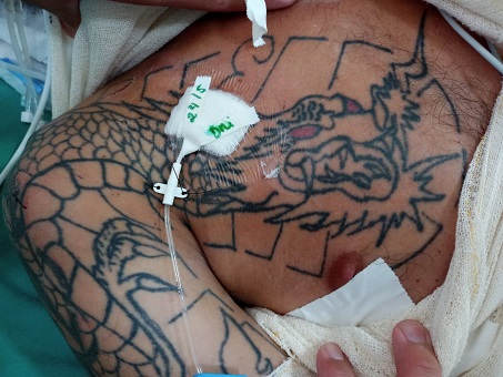 Leia mais sobre o artigo PS João Lúcio procura familiares de paciente internado na unidade