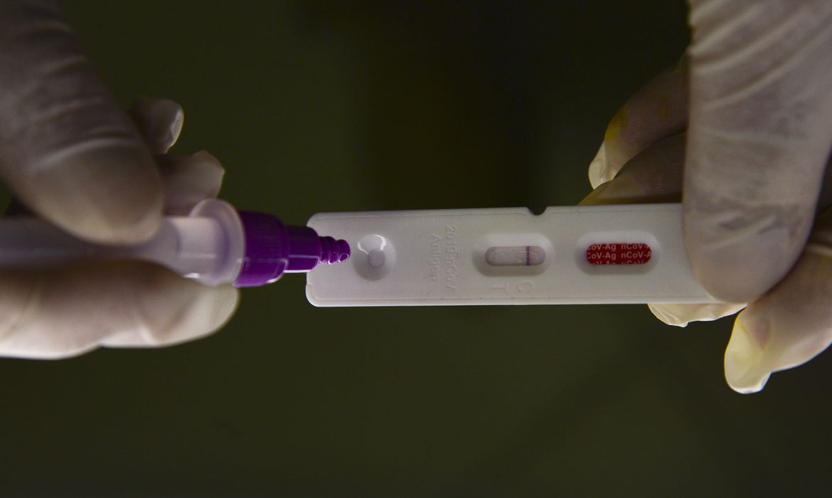 Leia mais sobre o artigo Brasil registra 18,5 mil novos casos e 53 mortes por covid-19