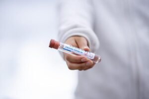 Leia mais sobre o artigo Brasil faz mais de 8 mil testes de varíola dos macacos