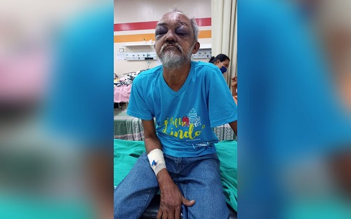 No momento, você está visualizando Hospital procura familiares de idoso internado após ser atropelado por ônibus em Manaus