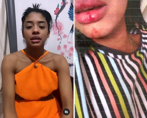 No momento, você está visualizando Defesa de ex-vocalista do Feras do Forró acusa cantor Maykinho de agressão