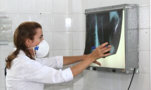 Leia mais sobre o artigo Governo cria comitê para reduzir casos de tuberculose até 2030
