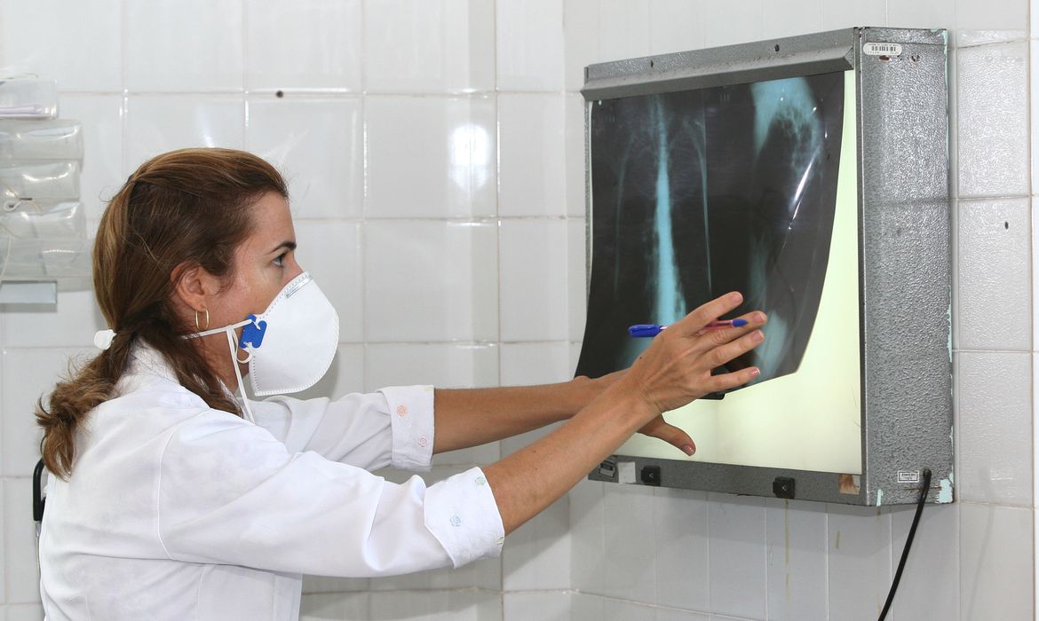 No momento, você está visualizando Governo cria comitê para reduzir casos de tuberculose até 2030